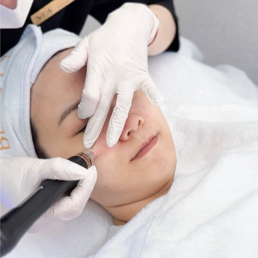 Aqua Peel 深層淨化