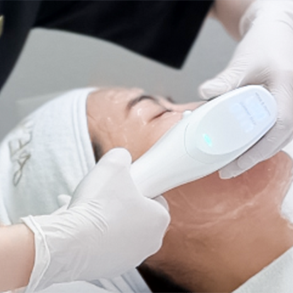 LinearZ音波（全面+下巴 600發）